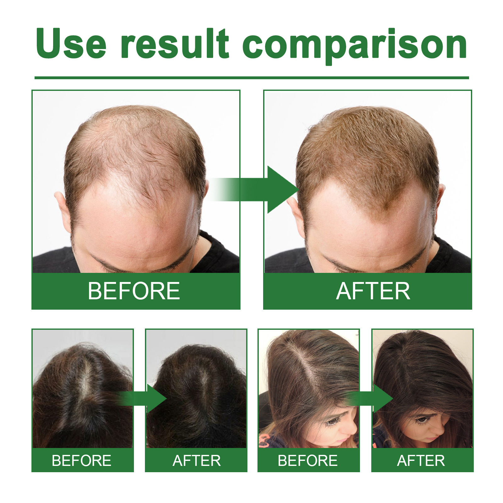 Rosemary Spray for Hair Nouris - огляд і ціна Hair Care Nature